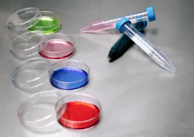 Abcodia’s partnership for pancreatic cancer biomarker discovery