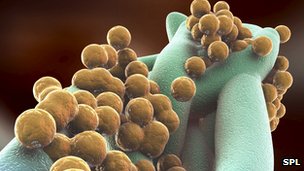 What is the alternative to ineffective antibiotics?